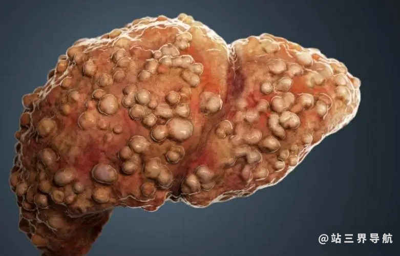 这些皮肤变化是肝病信号