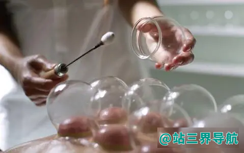 拔火罐注意事项和禁忌