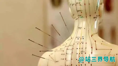 针灸扎哪个地方可以治疗失眠